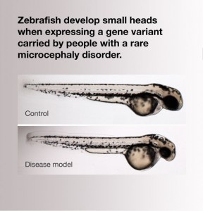 zebrafish microcephaly model