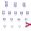 human chromosomes image