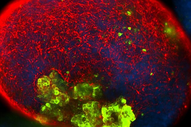 Stem cells (green) could someday be used to treat cancer, Parkinson's disease, spinal cord injuries, Lou Gehrig's disease, multiple sclerosis, Alzheimer's disease and retinitis pigmentosa, among other applications. Image courtesy of Christina Tu / Sue & Bill Gross Stem Cell Research Center. CC BY-NC-ND 2.0