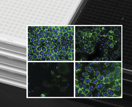 Foreground, 60× confocal images of Drosophila S2R+ cultured cells stained for DNA (DAPI; shown in blue) or filamentous Actin (Phalloidin; green). Top left, untreated cells. Clockwise from top right, cells treated with RNAi reagents directed against ncm, Rho1, or hoip. Background photo, 384-well microplates useful for high-throughput luminescence (white plates) or image-based assays (black clear-bottomed plates). Image courtesy of Stephanie Mohr. See Mohr et al. 1919–1924." width="666" height="542