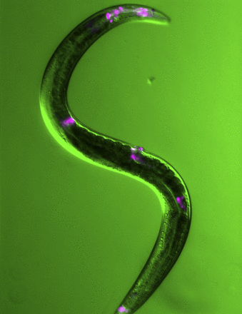 False-color image of live transgenic Caenorhabditis elegans expressing VAV-1 fused with a fluorescent protein. VAV-1 is found in a restricted number of sites in worms (pink areas), including a single neuron involved in regulating sleep. Image courtesy of Amanda Fry and Ken Norman.