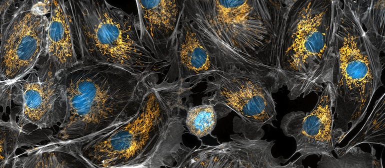 In this microscopic image of cow cells, the nucleus is stained blue and the hundreds of mitochondria in each cell are stained golden yellow. Photo by Torsten Wittmann via NIH Image Gallery on Flickr.