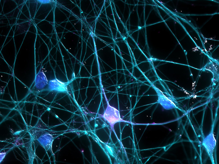 Neurons. Photo by Ardy Rahman via Flickr.