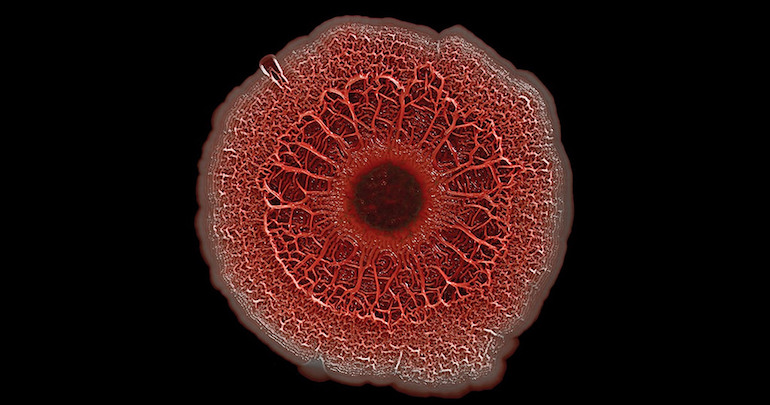 A bacterial biofilm. Photo by NIH Image Gallery via Flickr.